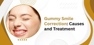 Gummy Smile Correction: Causes and Treatment